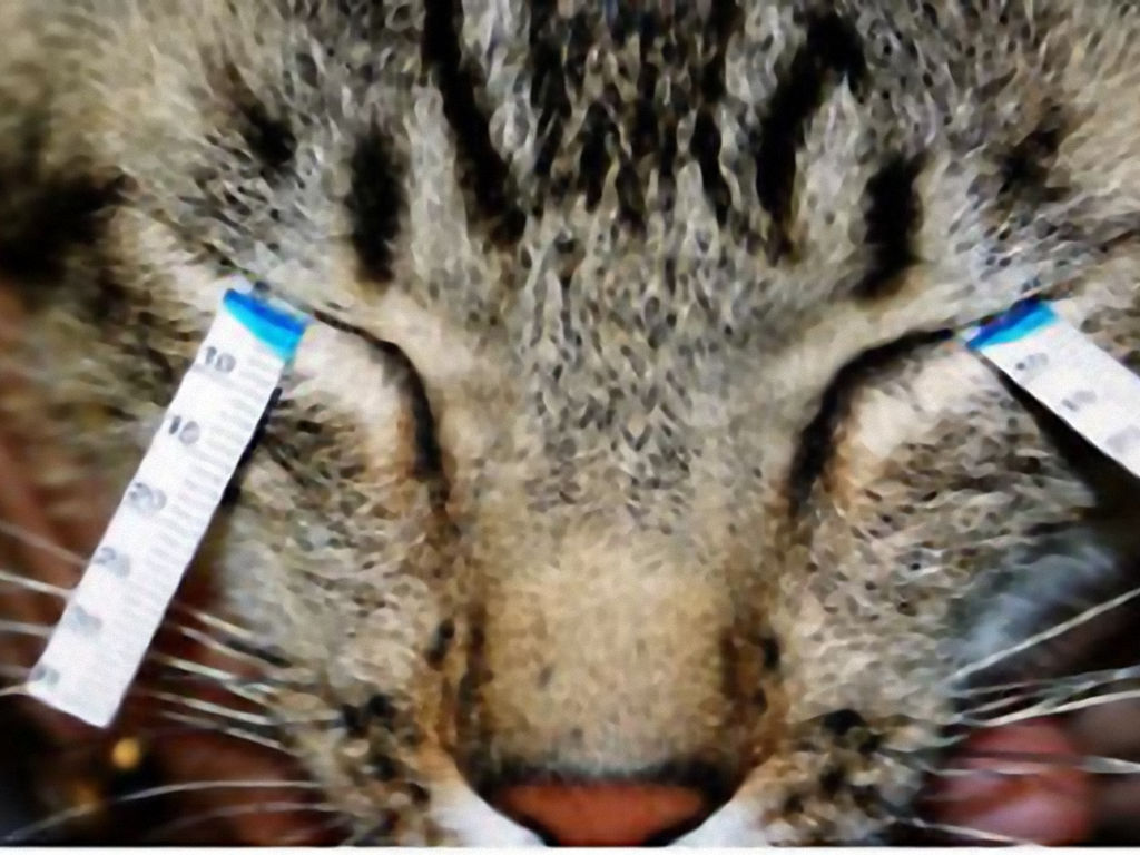 Cheratocongiuntivite secca