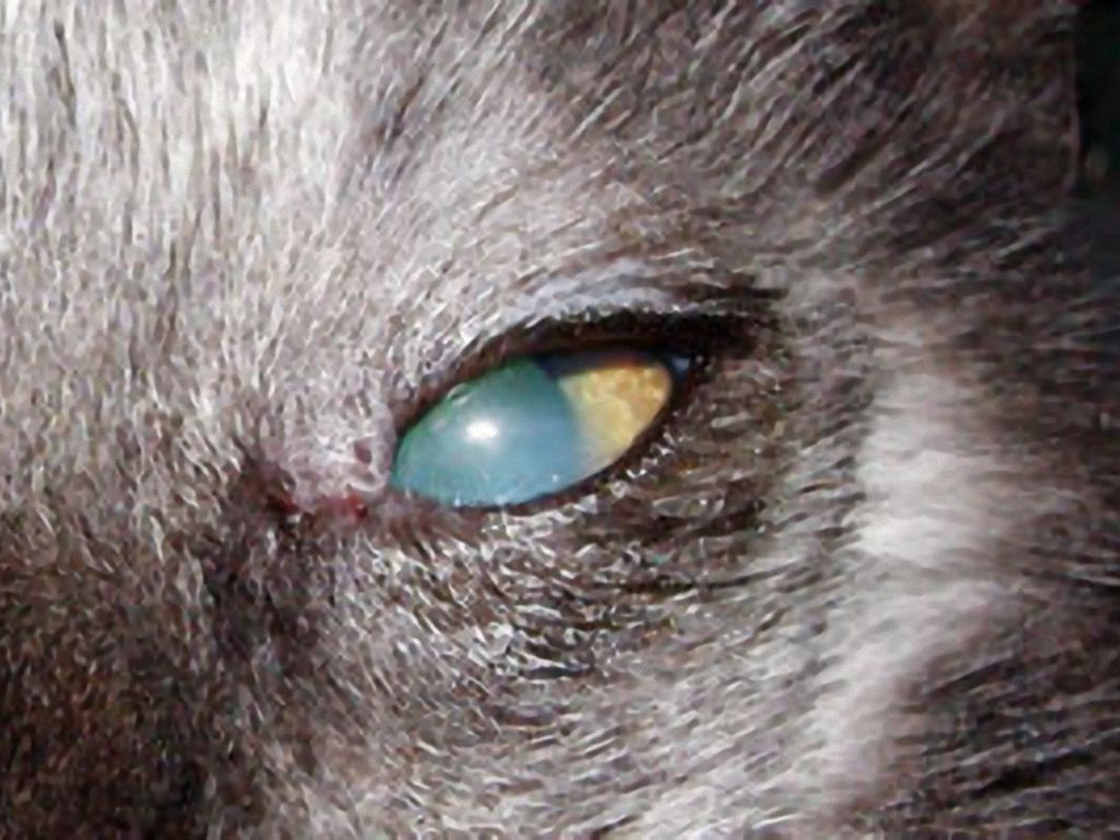 Lussazione del cristallino